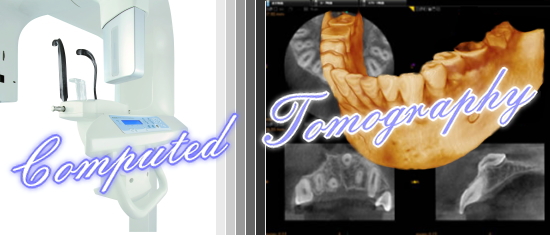 歯科用CT(3D)