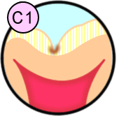 C1