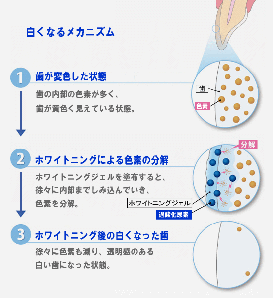白くなるメカニズム